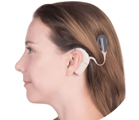 Cochlear-2-1