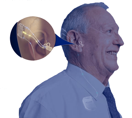 acclaim-cochlear-2