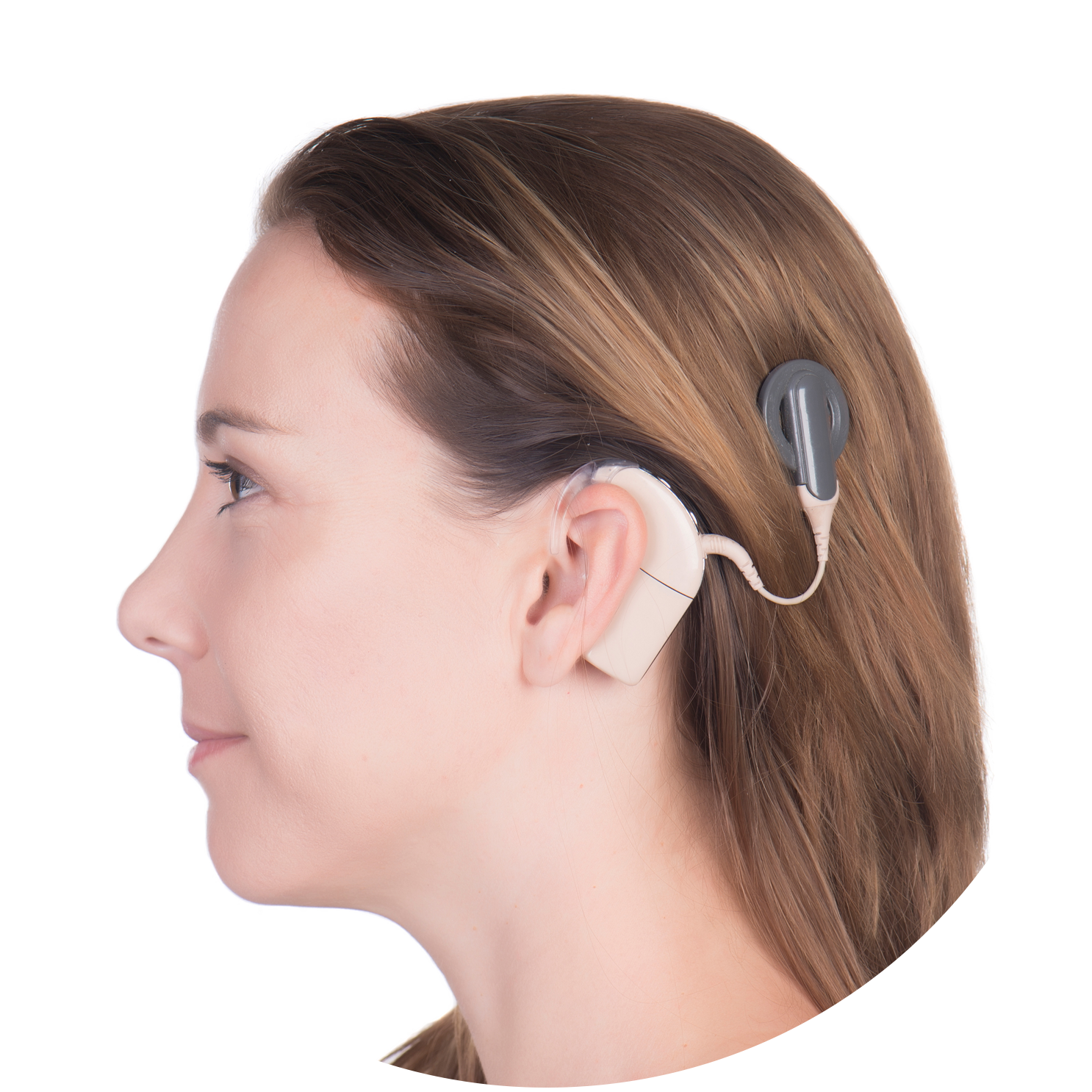 Cochlear Implant