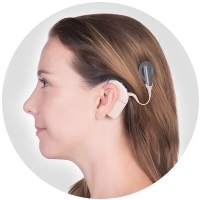 CochlearImplants