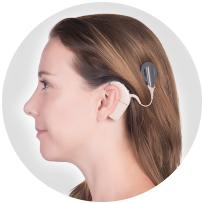 CochlearImplants