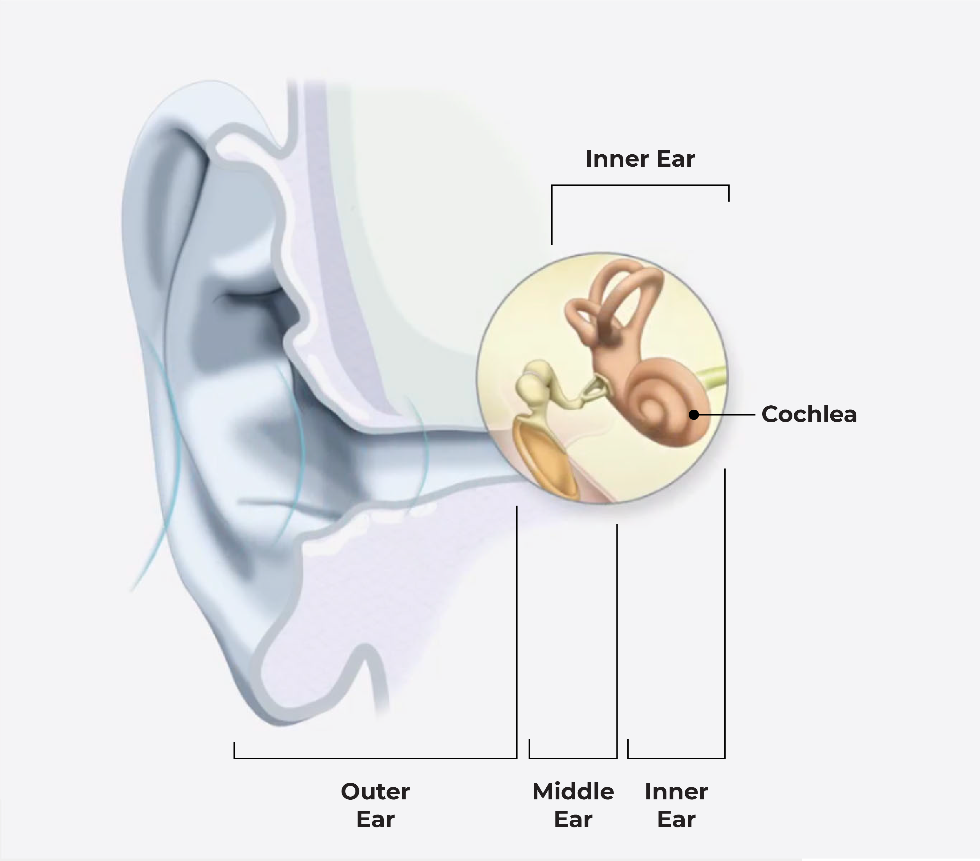 hearing loss ear diagram