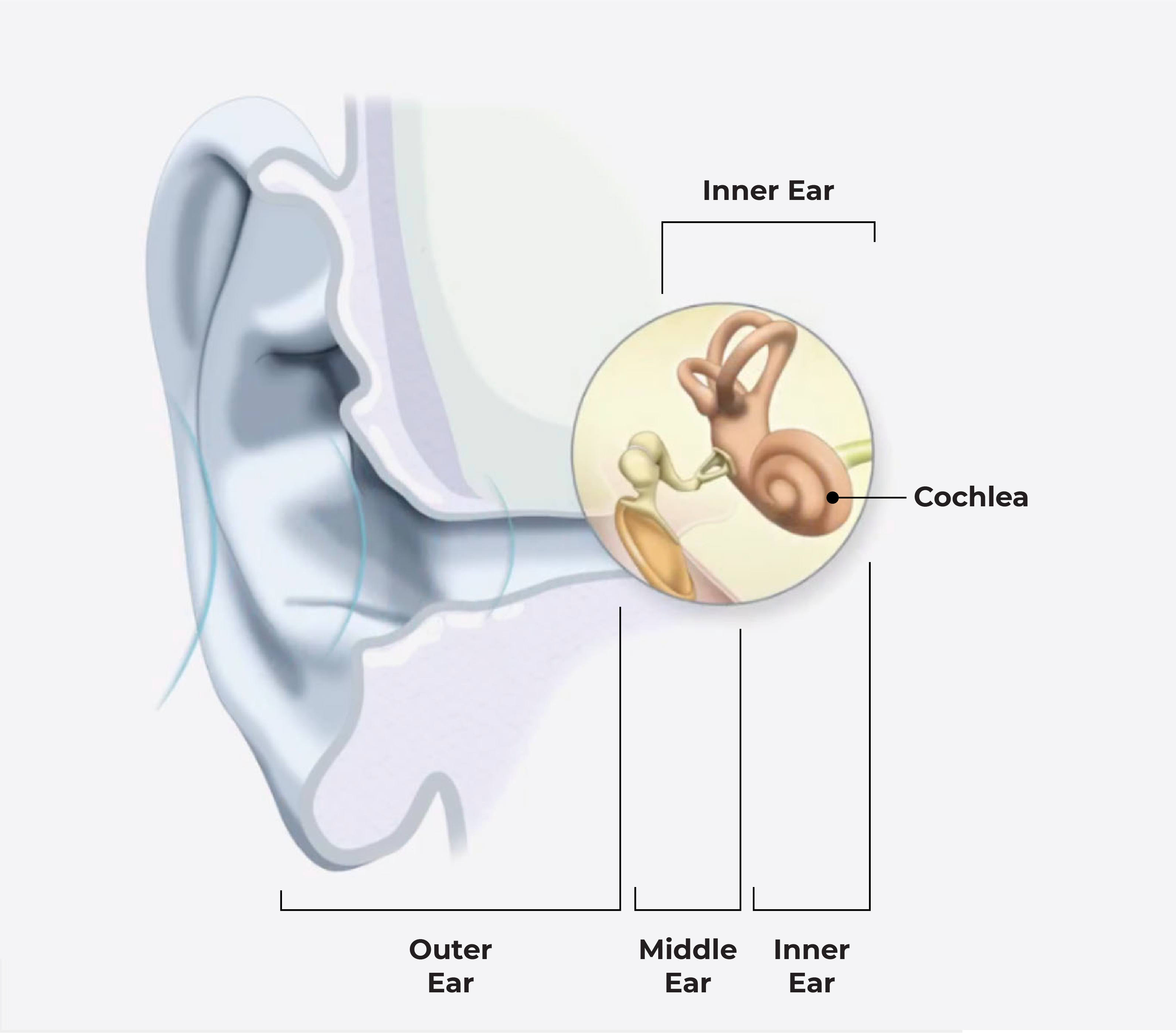 hearing loss ear diagram